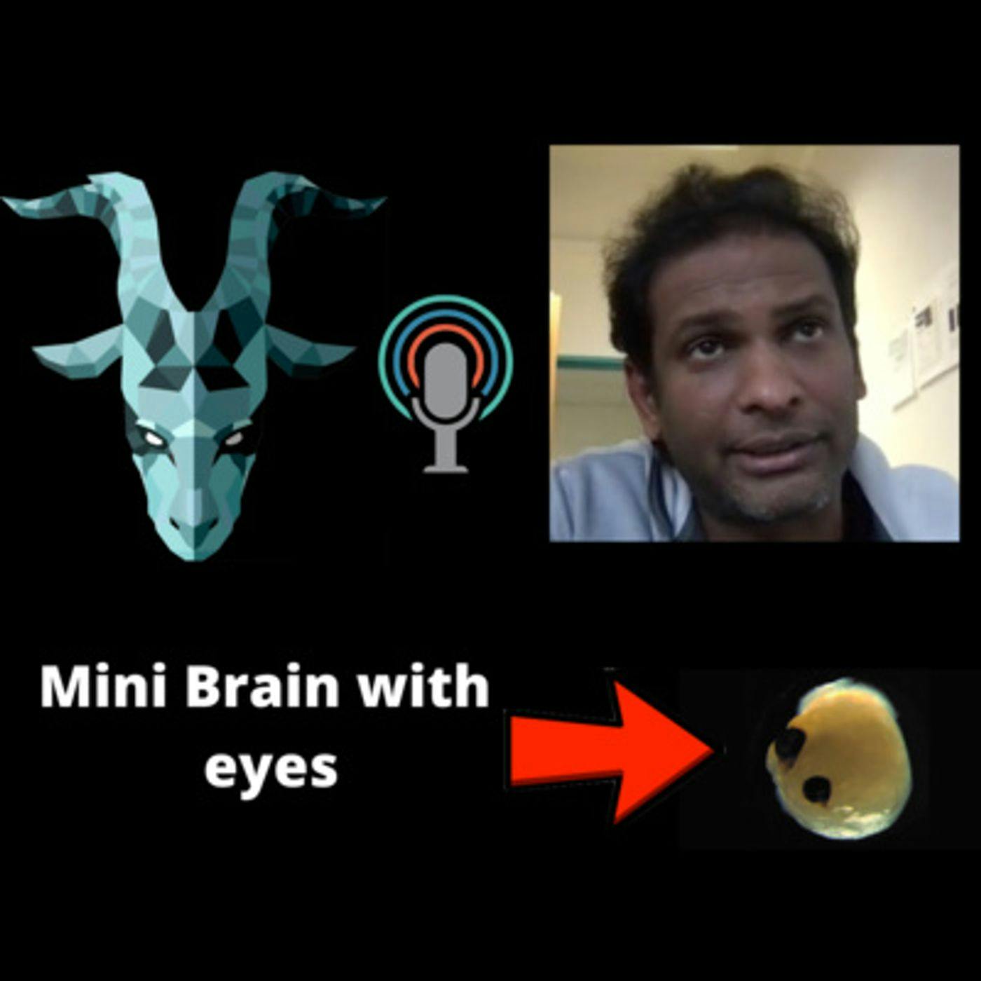 Interviewing the scientist who grew a mini brain with eyes (ft. Dr. Jay Gopalakrishnan)